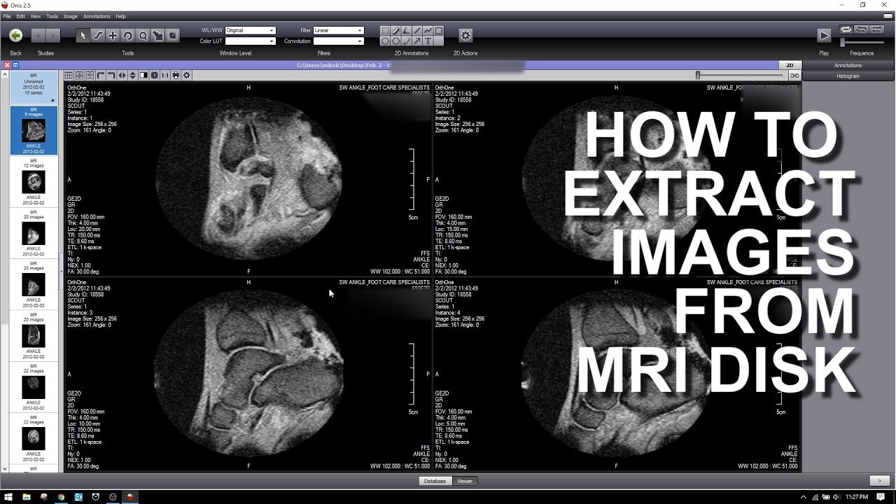 mckesson radiology viewer